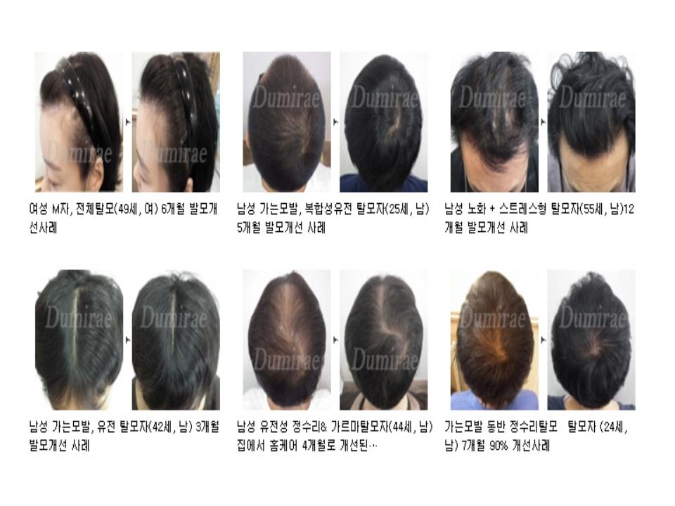 두미래 임상 사례 모음 2